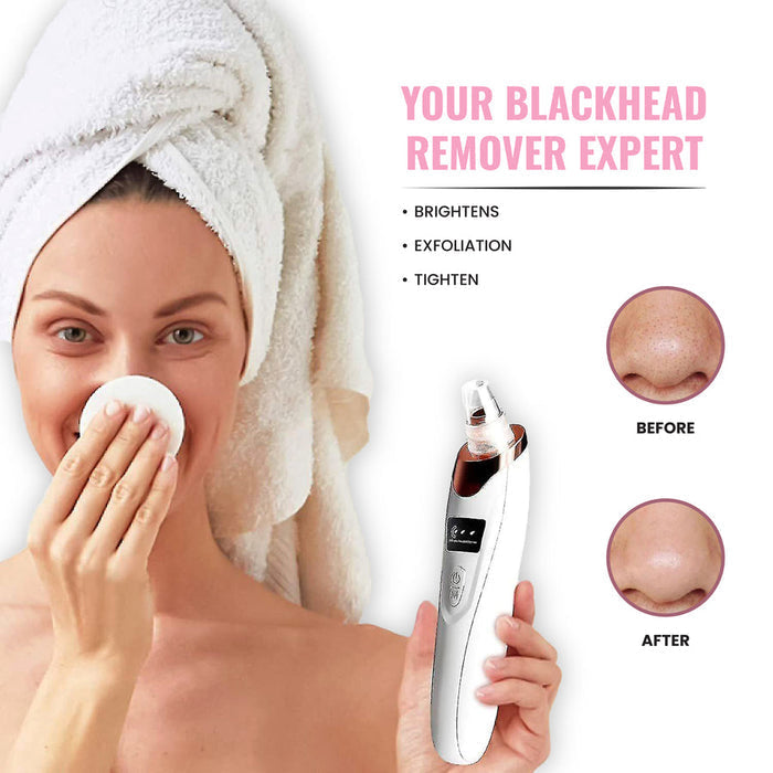 FACIAL BLACKHEAD SUCTION REMOVER